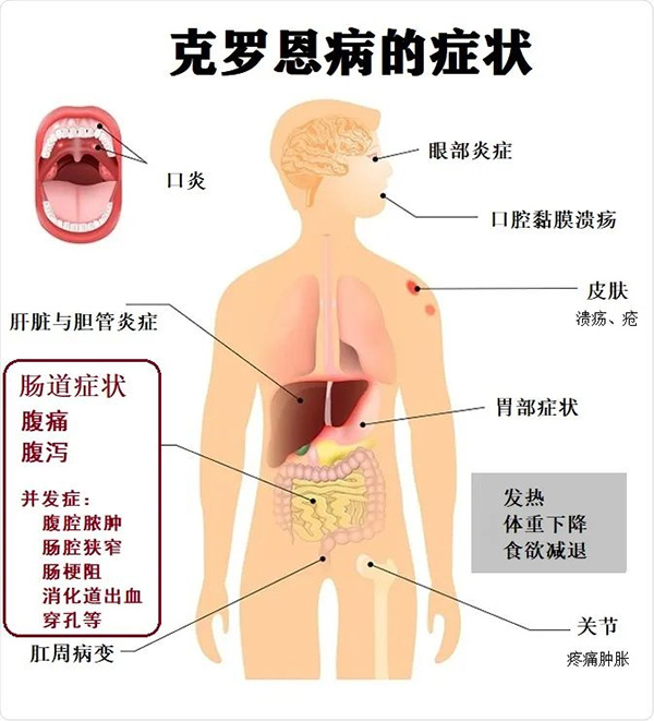 图片12.jpg